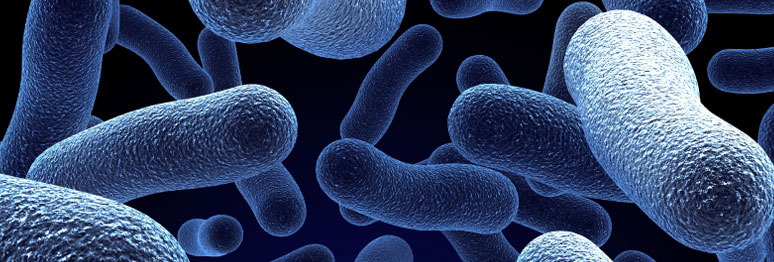 Legionella - Preventing or controlling the risk